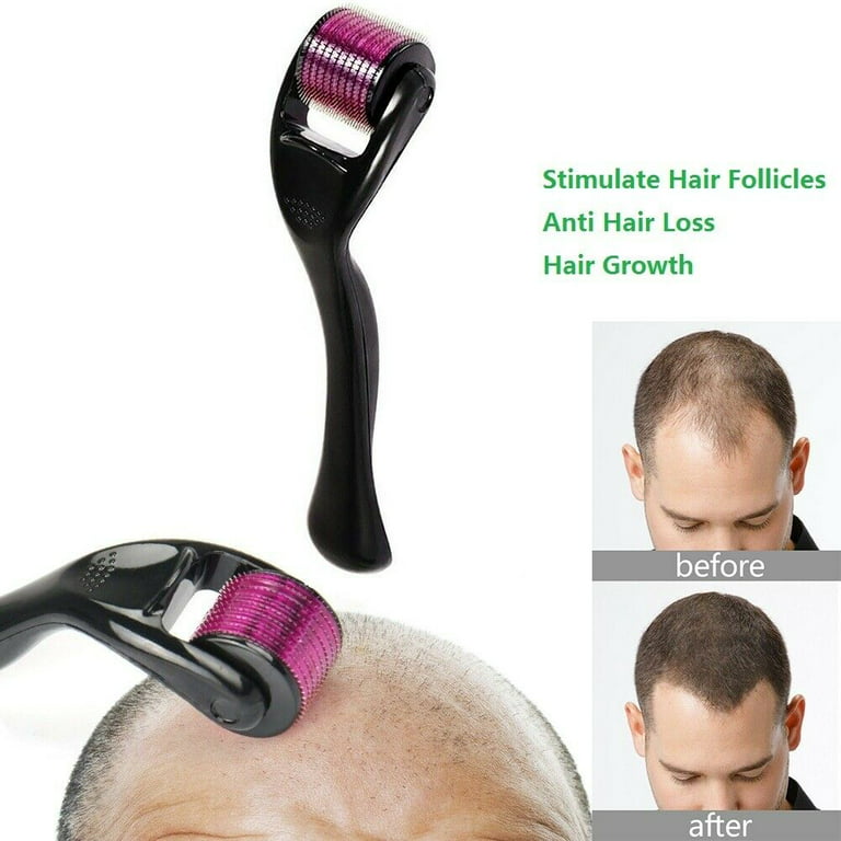 Professional Derma Roller for Hair & Beard Growth – Anti-Aging Face Scalp Care