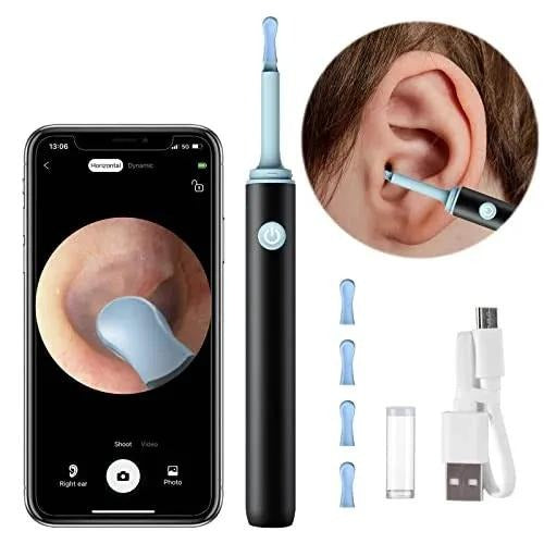 HD Wireless Ear Cleaner with Camera & LED – Smart Precision Ear Wax Removal Tool