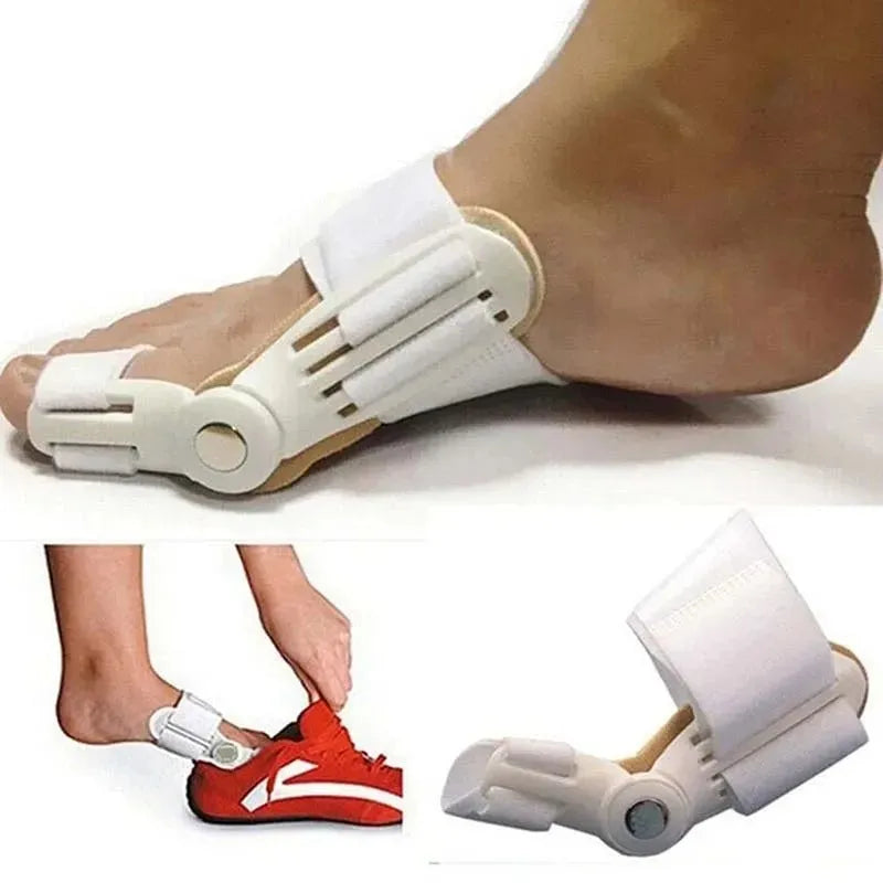 Adjustable Toe Splitter & Bunion Splint – Instant Pain Relief for Thumb Valgus