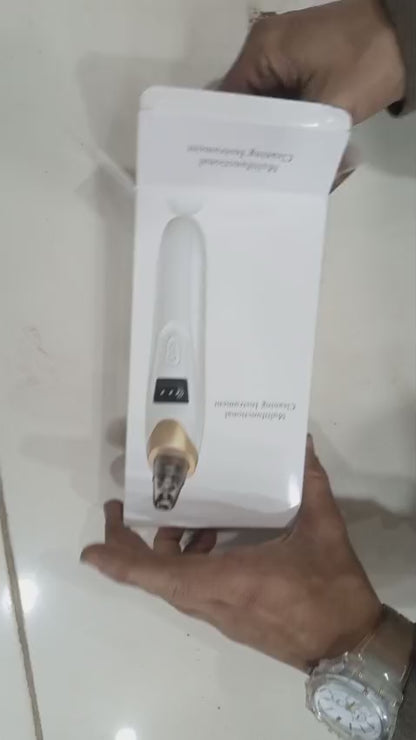 Deep Pore Cleansing Blackhead Remover – Rechargeable Skin Care Vacuum